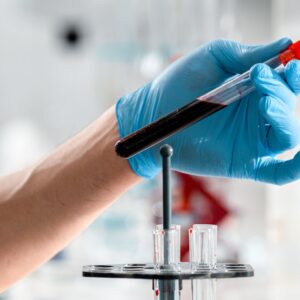 Pruebas de Laboratorio